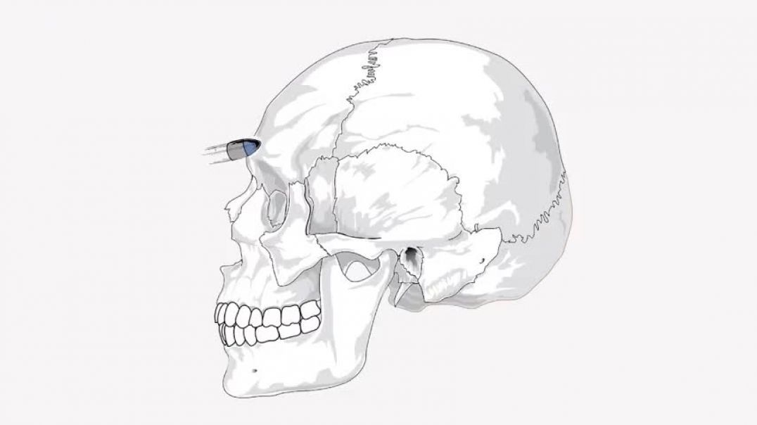 ⁣Anatomy of a Headshot