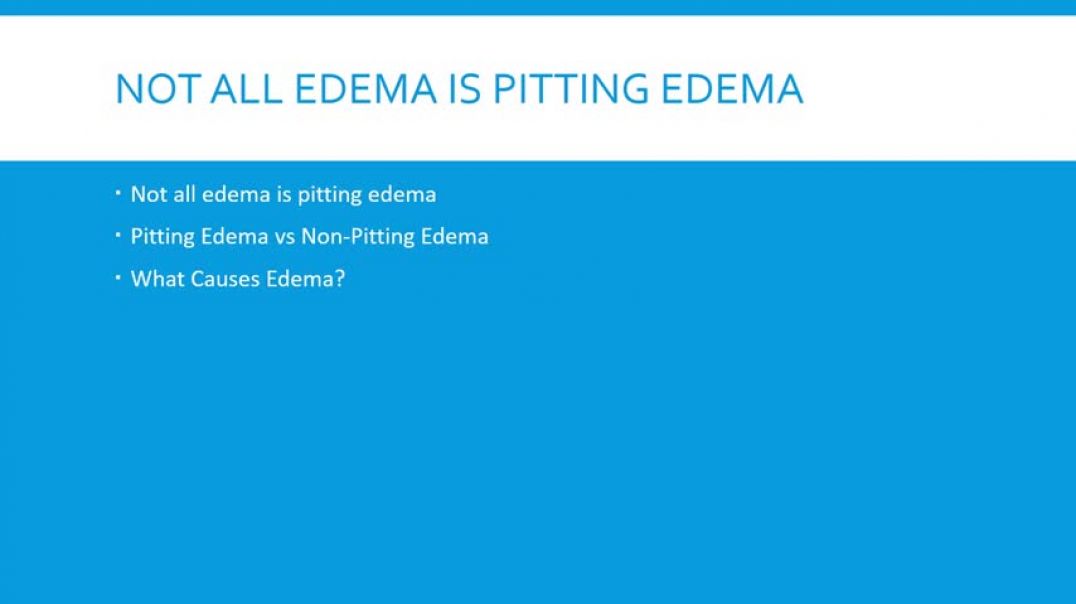 ⁣Pitting Edema Grading Scale (4 Levels)