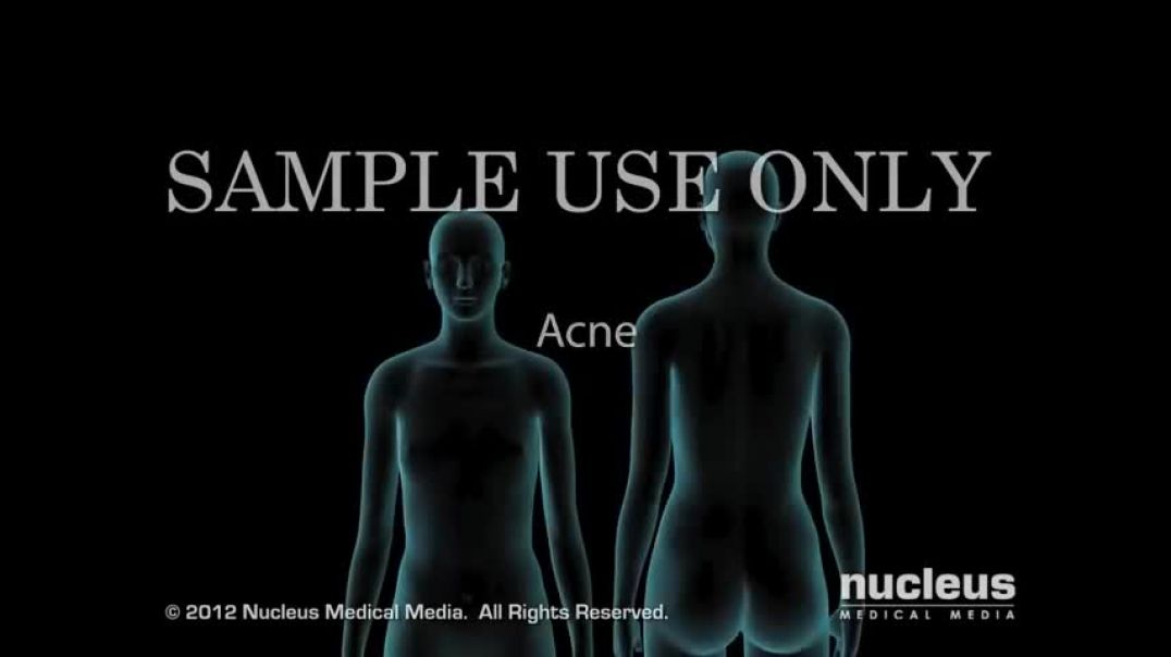 ⁣Acne   Nucleus Health