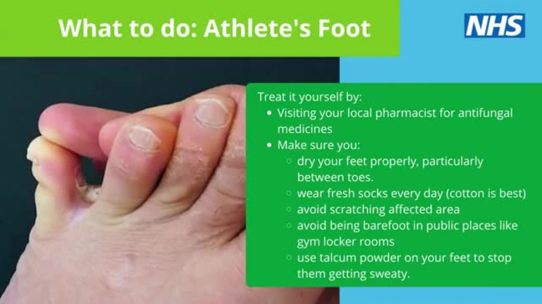⁣Self care Athletes foot