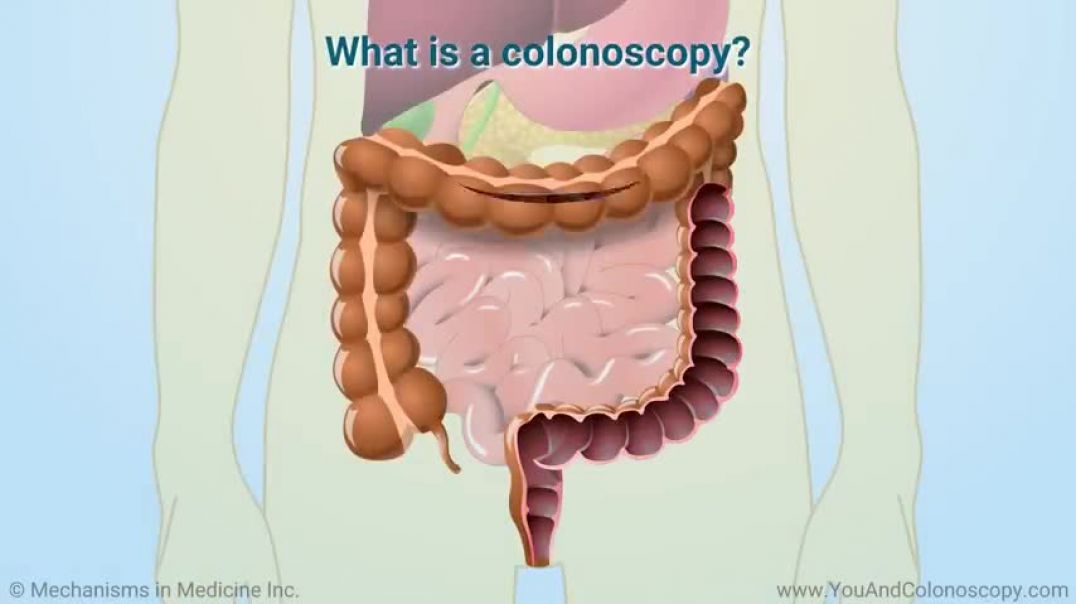 ⁣What happens during and after a colonoscopy
