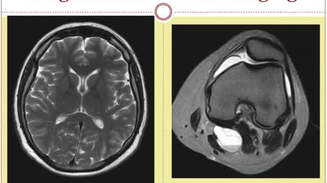 ⁣MRI and MRA scans -  What is the difference