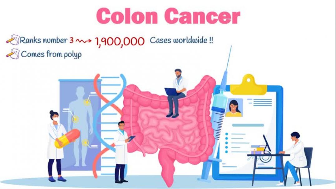 ⁣Colon cancer: 6 EARLY symptoms & why they occur | Colon cancer symptoms | colorectal cancer