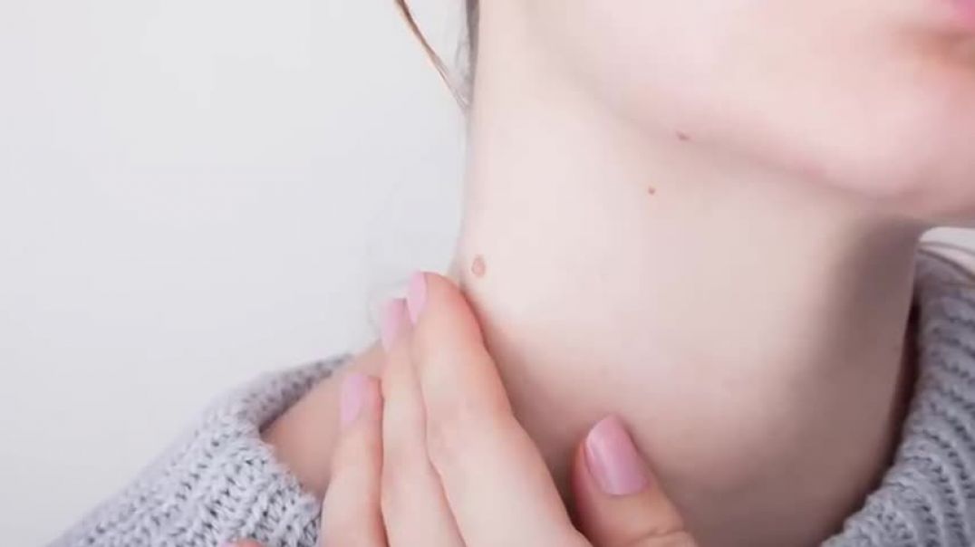 ⁣How to Remove Skin Tags and Warts Overnight - Dr. Berg Explains